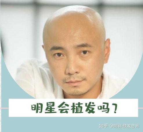 植发明星爆料视频完整版,揭秘植发全过程与真实效果